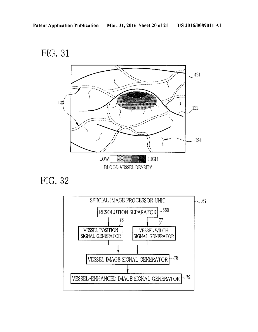 ENDOSCOPE SYSTEM, PROCESSOR DEVICE, AND METHOD FOR OPERATING ENDOSCOPE     SYSTEM - diagram, schematic, and image 21