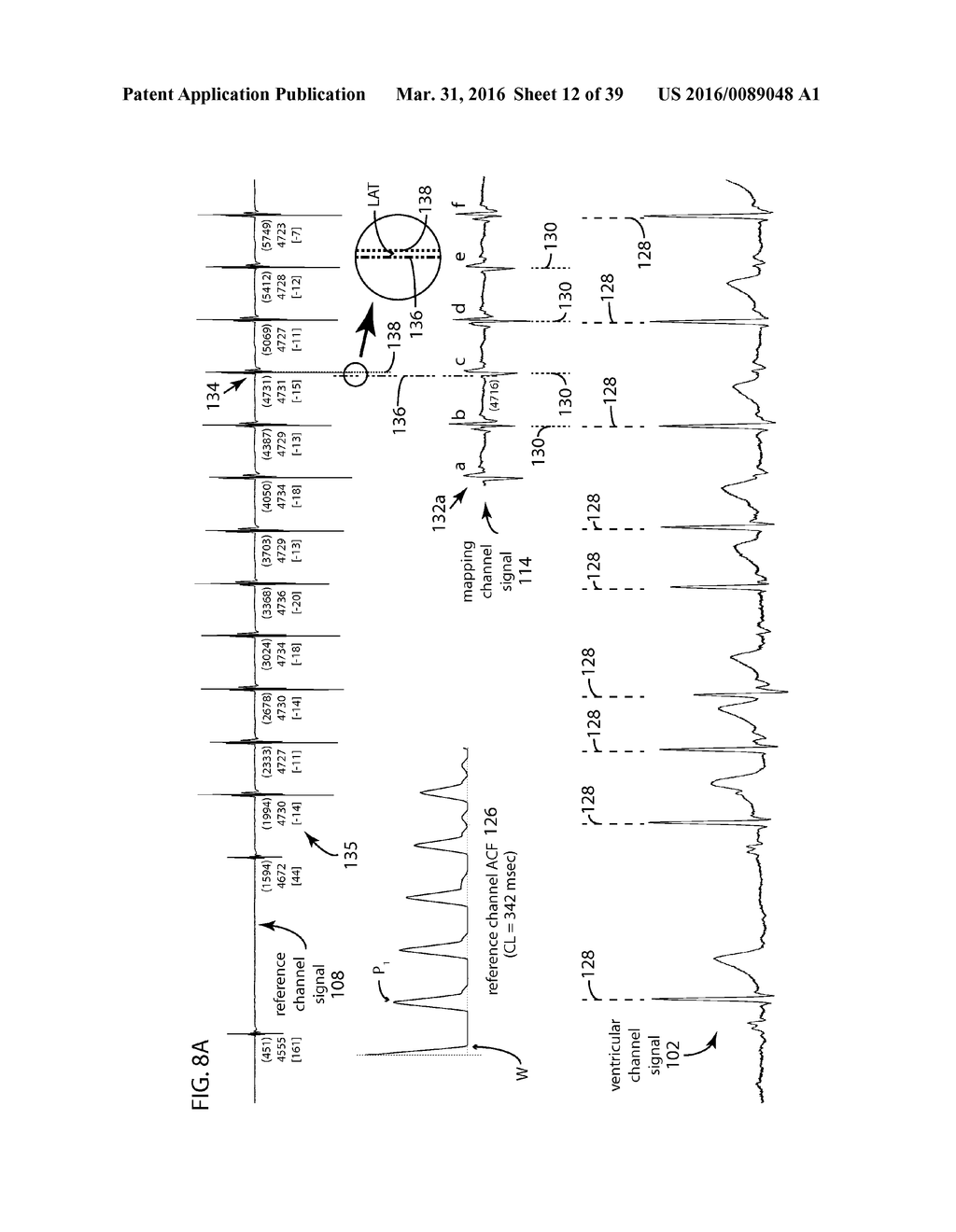 TIME TRANSFORMATION OF LOCAL ACTIVATION TIMES - diagram, schematic, and image 13