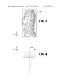 VERTEBRA SEGMENTATION APPARATUS, METHOD AND RECORDING MEDIUM diagram and image