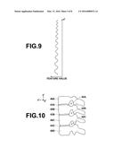 VERTEBRA SEGMENTATION APPARATUS, METHOD AND RECORDING MEDIUM diagram and image