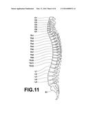 VERTEBRA SEGMENTATION APPARATUS, METHOD AND RECORDING MEDIUM diagram and image