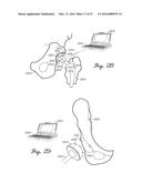 Prosthetic Knee Joint Measurement System Including Energy Harvesting And     Method Therefor diagram and image