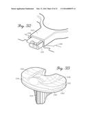 Prosthetic Knee Joint Measurement System Including Energy Harvesting And     Method Therefor diagram and image