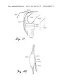 Prosthetic Knee Joint Measurement System Including Energy Harvesting And     Method Therefor diagram and image