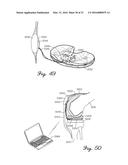 Prosthetic Knee Joint Measurement System Including Energy Harvesting And     Method Therefor diagram and image