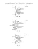 ENERGY-BASED LYMPH NODE DISSECTION DEVICE diagram and image