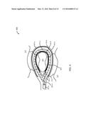 ENERGY-BASED LYMPH NODE DISSECTION DEVICE diagram and image