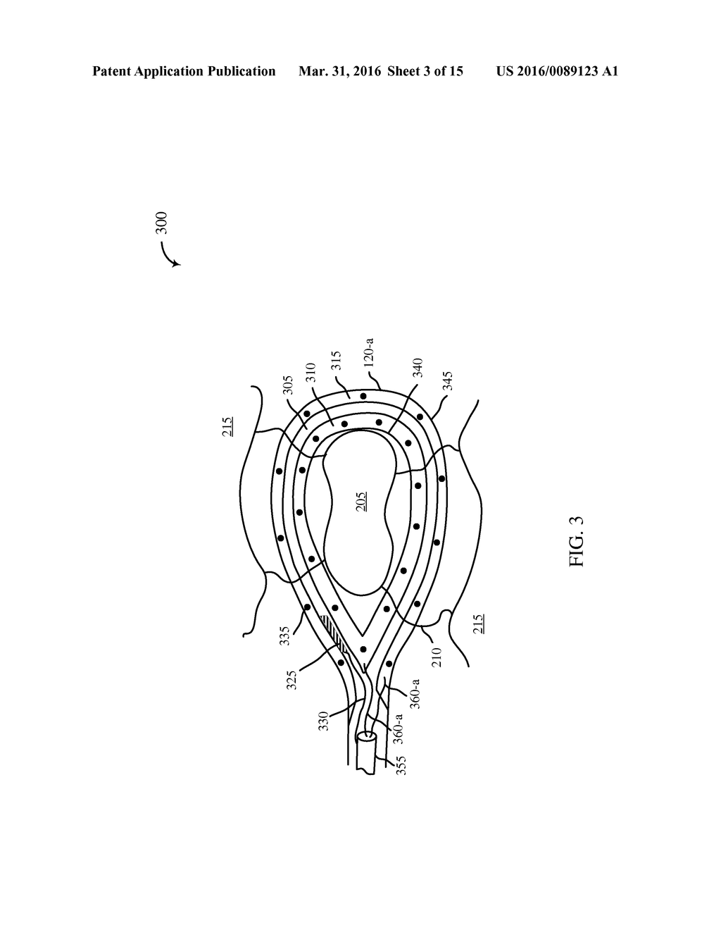 THORACIC BIOPSY INSTRUMENT WITH BIPOLAR SEALING AND BLADE TECHNOLOGY - diagram, schematic, and image 04