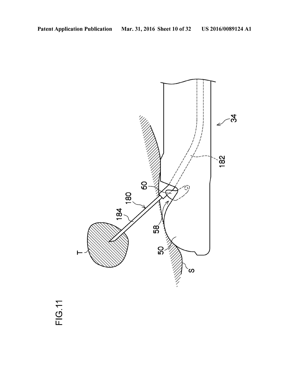 ENDOSCOPE APPARATUS - diagram, schematic, and image 11