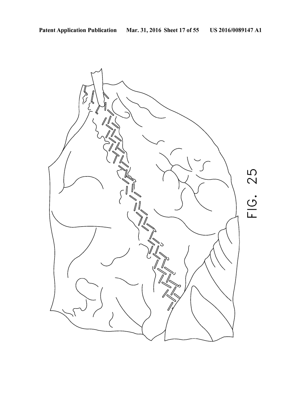 SURGICAL STAPLE AND DRIVER ARRANGEMENTS FOR STAPLE CARTRIDGES - diagram, schematic, and image 18