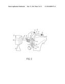 PATIENT SPECIFIC INSTRUMENTATION (PSI) FOR ORTHOPEDIC SURGERY AND SYSTEMS     AND METHODS FOR USING X-RAYS TO PRODUCE SAME diagram and image