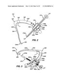 Side-Loading Carriage for Use in Surgical Guide diagram and image