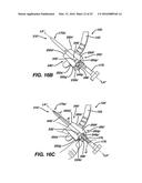 Side-Loading Carriage for Use in Surgical Guide diagram and image