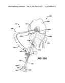 Side-Loading Carriage for Use in Surgical Guide diagram and image