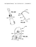 Side-Loading Carriage for Use in Surgical Guide diagram and image