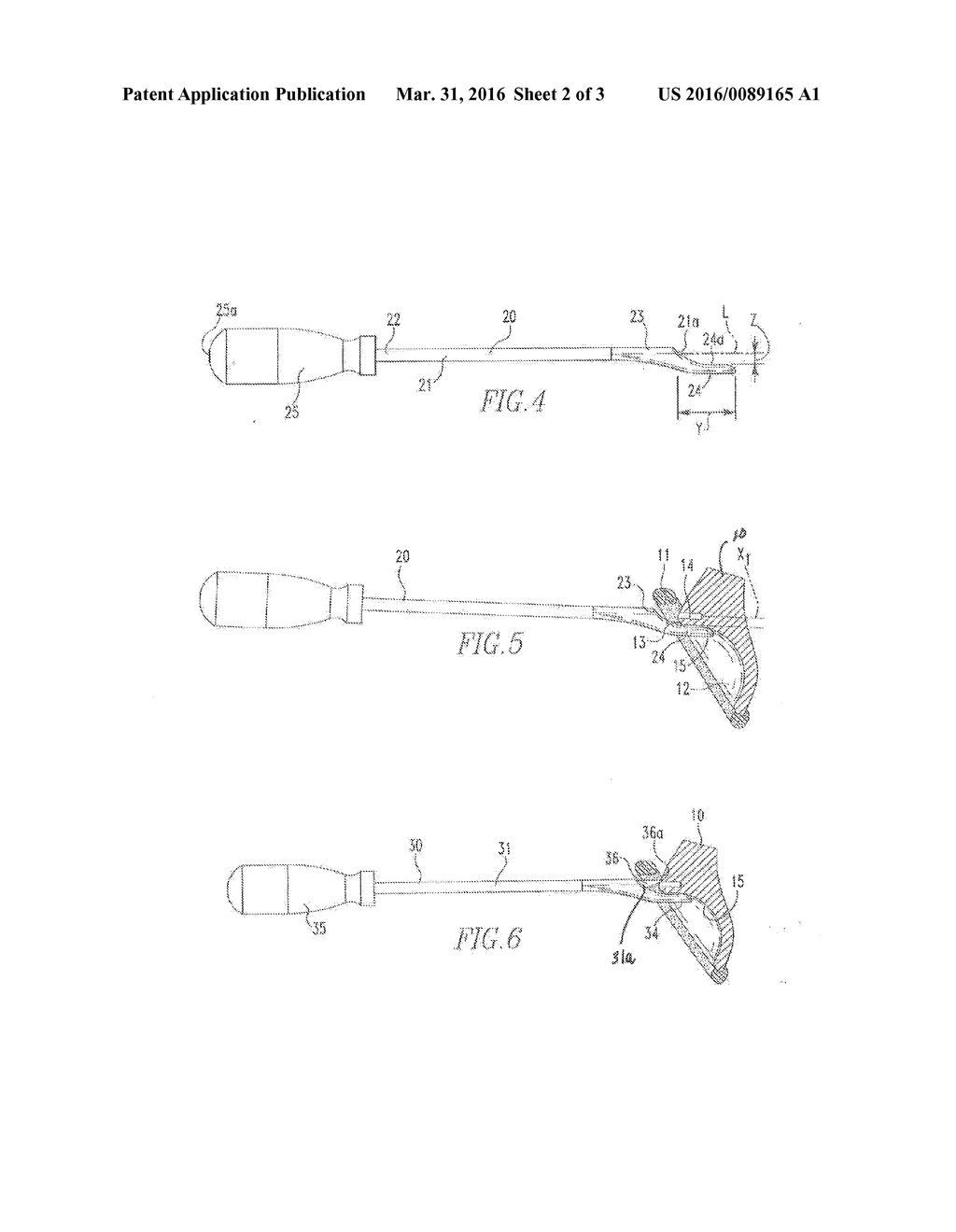 ANTHROSCOPIC JOINT REPAIR - diagram, schematic, and image 03