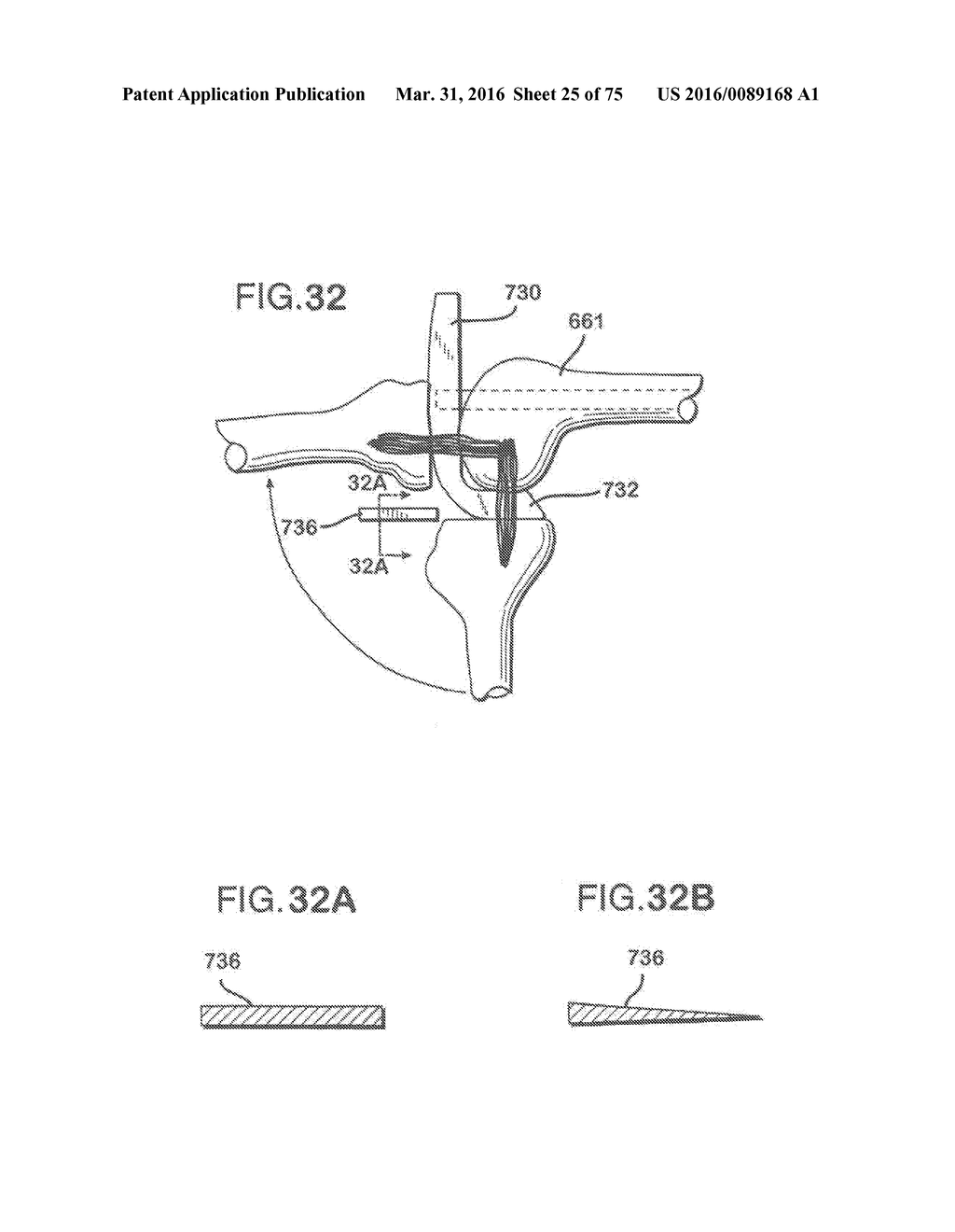 METHOD AND APPARATUS FOR TOTAL KNEE ARTHROPLASTY - diagram, schematic, and image 26