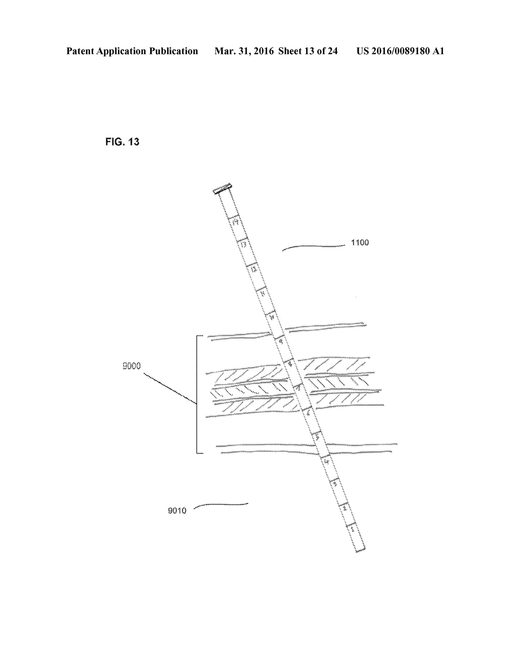 SURGICAL TOOLS AND SYSTEM FOR SAFELY ACCESSING BODY CAVITIES AND METHODS     OF USING THE SAME - diagram, schematic, and image 14