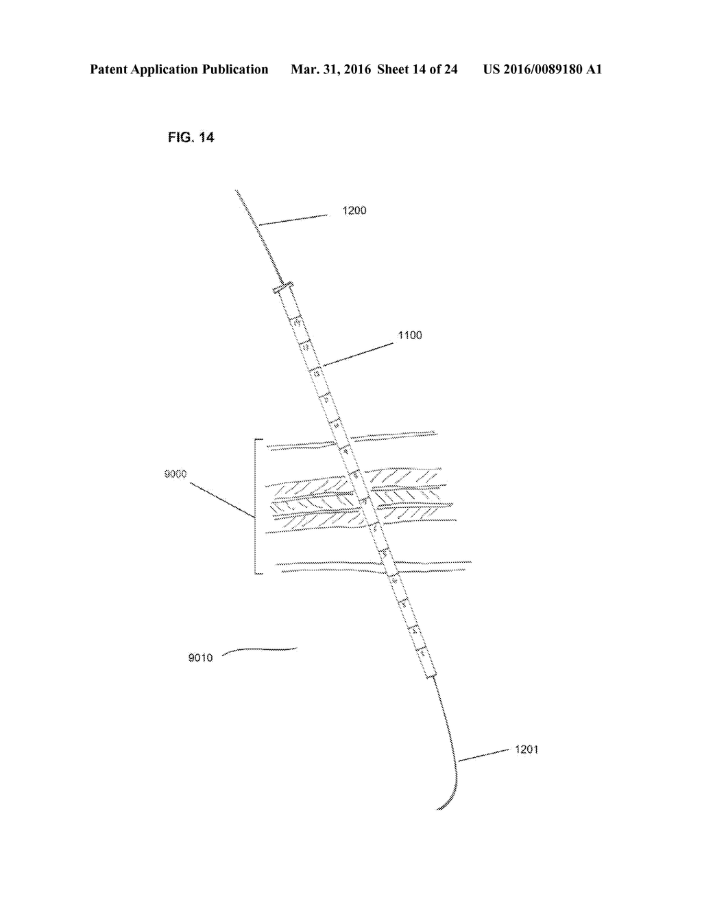 SURGICAL TOOLS AND SYSTEM FOR SAFELY ACCESSING BODY CAVITIES AND METHODS     OF USING THE SAME - diagram, schematic, and image 15