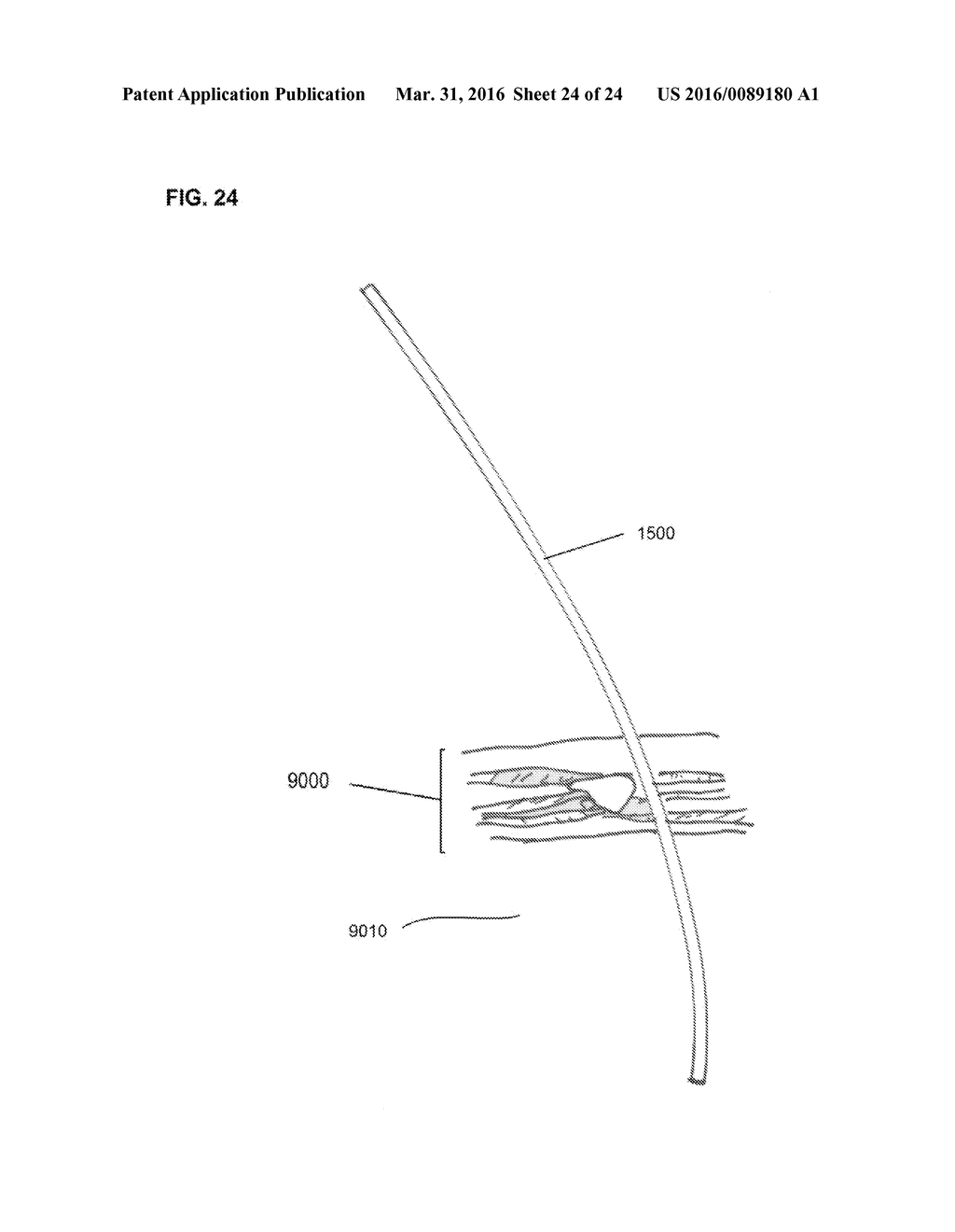 SURGICAL TOOLS AND SYSTEM FOR SAFELY ACCESSING BODY CAVITIES AND METHODS     OF USING THE SAME - diagram, schematic, and image 25