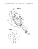 SURGICAL STABILIZER AND CLOSURE SYSTEM diagram and image