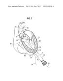 SURGICAL STABILIZER AND CLOSURE SYSTEM diagram and image