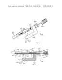 INTRAMEDULLARY FRACTURE FIXATION DEVICES AND METHODS diagram and image