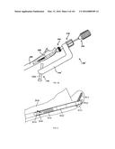 INTRAMEDULLARY FRACTURE FIXATION DEVICES AND METHODS diagram and image