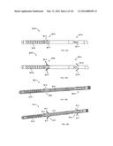 INTRAMEDULLARY FRACTURE FIXATION DEVICES AND METHODS diagram and image