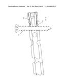 INTRAMEDULLARY FRACTURE FIXATION DEVICES AND METHODS diagram and image