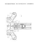 INTRAMEDULLARY FRACTURE FIXATION DEVICES AND METHODS diagram and image