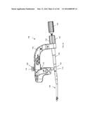 INTRAMEDULLARY FRACTURE FIXATION DEVICES AND METHODS diagram and image