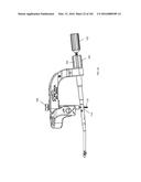 INTRAMEDULLARY FRACTURE FIXATION DEVICES AND METHODS diagram and image