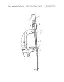 INTRAMEDULLARY FRACTURE FIXATION DEVICES AND METHODS diagram and image