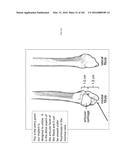 INTRAMEDULLARY FRACTURE FIXATION DEVICES AND METHODS diagram and image