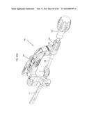 INTRAMEDULLARY FRACTURE FIXATION DEVICES AND METHODS diagram and image