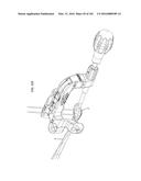 INTRAMEDULLARY FRACTURE FIXATION DEVICES AND METHODS diagram and image