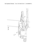 INTRAMEDULLARY FRACTURE FIXATION DEVICES AND METHODS diagram and image