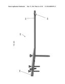 INTRAMEDULLARY FRACTURE FIXATION DEVICES AND METHODS diagram and image