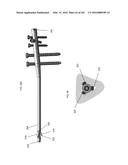 INTRAMEDULLARY FRACTURE FIXATION DEVICES AND METHODS diagram and image