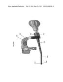 INTRAMEDULLARY FRACTURE FIXATION DEVICES AND METHODS diagram and image