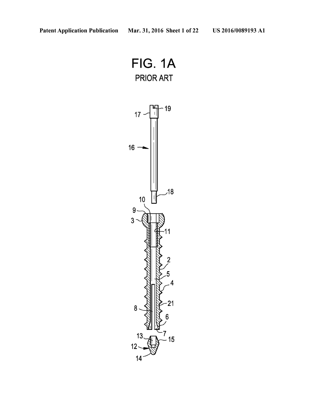 Expansion Screw Bone Tamp - diagram, schematic, and image 02