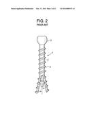 Expansion Screw Bone Tamp diagram and image