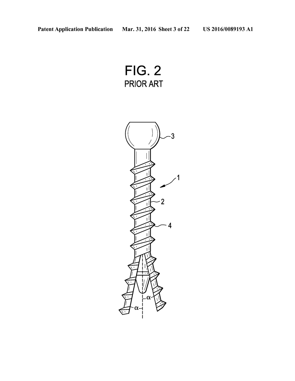 Expansion Screw Bone Tamp - diagram, schematic, and image 04