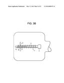 Expansion Screw Bone Tamp diagram and image