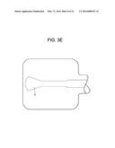 Expansion Screw Bone Tamp diagram and image