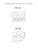 Expansion Screw Bone Tamp diagram and image