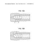 Expansion Screw Bone Tamp diagram and image