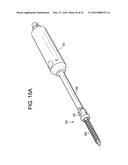 Expansion Screw Bone Tamp diagram and image