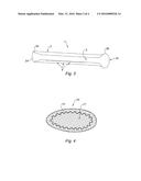 Whale Concept - Folding Mesh for TIPP procedure for Inguinal Hernia diagram and image